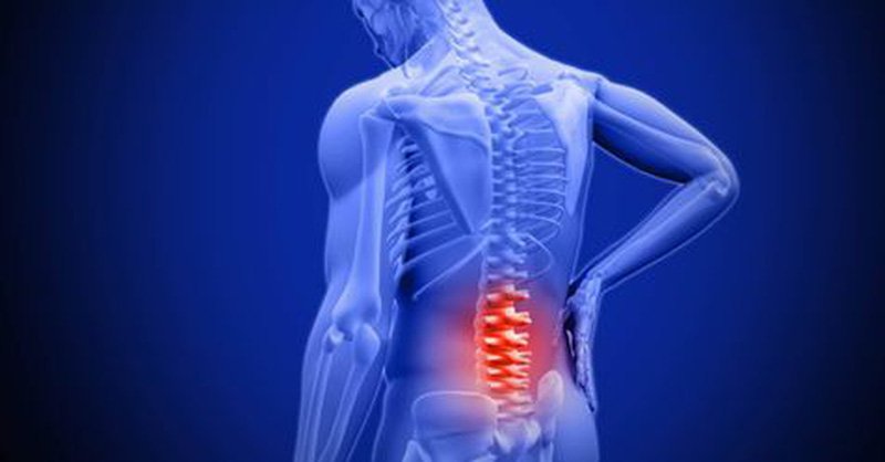 BIỆU HIỆN VÀ ĐIỀU TRỊ VIÊM CỘT SỐNG DÍNH KHỚP