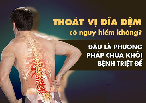 ĐIỀU TRỊ THOÁT VỊ ĐĨA ĐỆM BẰNG SÓNG RADIO CAO TẦN