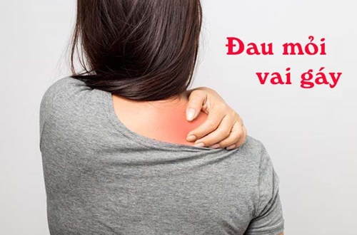 ĐAU MỎI VAI GÁY :CẢNH BÁO