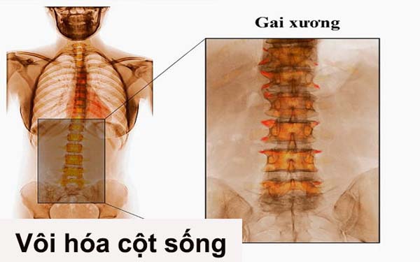 PHƯƠNG PHÁP ĐIỀU TRỊ
