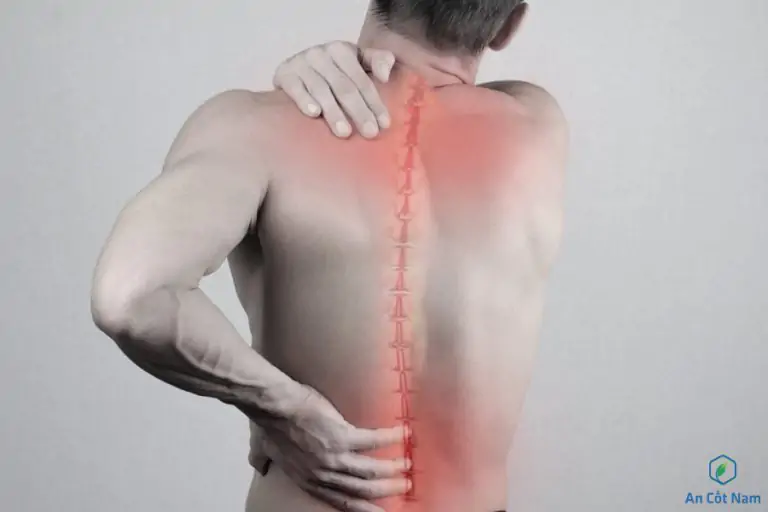 THOÁI HÓA CỘT SỐNG THẮT LƯNG- NGUYÊN NHÂN VÀ HƯỚNG ĐIỀU TRỊ