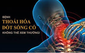 THOÁI HÓA ĐỐT SỐNG CỔ CHỮA THẾ NÀO MỚI HIỆU QUẢ