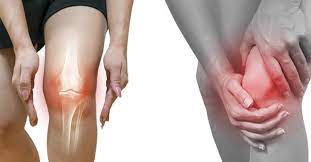 Chữa viêm khớp gối khỏi lâu dài