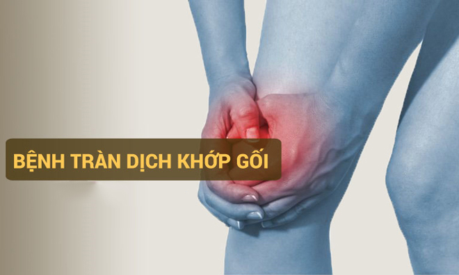 VIÊM KHỚP GỐI TRÀN DỊCH