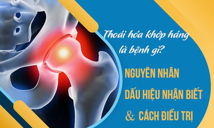 THOÁI HÓA KHỚP HÁNG VÀ CÁCH ĐIỀU TRỊ