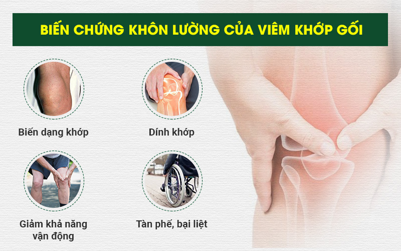 PHƯƠNG PHÁP ĐIỀU TRỊ GAI KHỚP GỐI HIỆU QUẢ