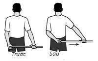 Những điều cần biết về bệnh thoát vị đĩa đệm