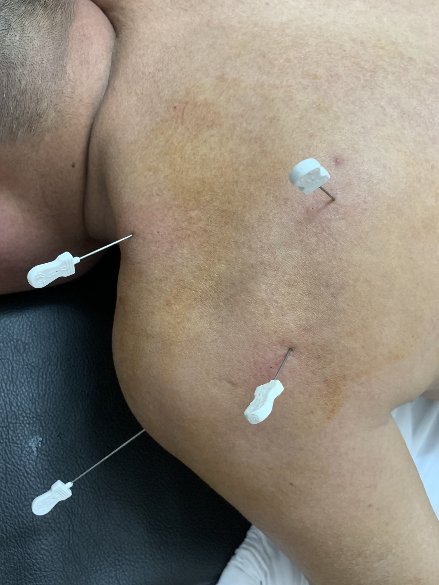 Phòng Khám An Thái - Chuyên Khoa Xương Khớp