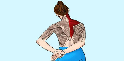 Bài tập chữa đau vai gáy căng duỗi cơ hình thang